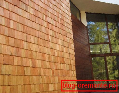Shingles