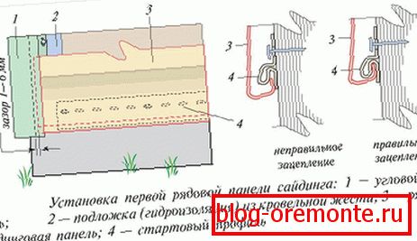 Starting plate installation method